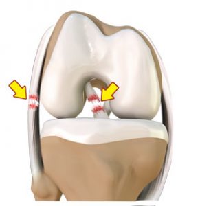 LIGAMENTOS