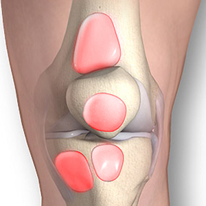 Bursitis