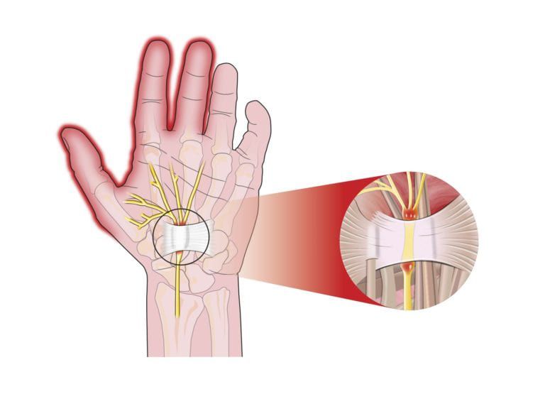 Tunel Carpo anatomia