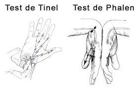 Tunel Carpo test